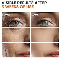 Everyouth Vitamin C Serum 20% with Hyaluronic Acid, Niacinamide & Collagen Peptides - 1 oz — image 5