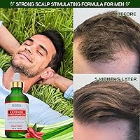 Botanical Hair Growth Treatment 4 Fl Oz — image 5