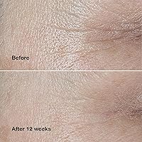 Clinique Smart Clinical Repair Wrinkle Correcting Face Cream 75mL — image 4