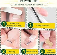 Fuzzycare Titanium Alloy Ingrown Toenail Treatment Kit, 10 Pcs — image 5