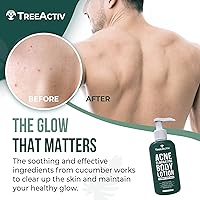 TreeActiv Acne Eliminating Body Lotion 8oz — image 2