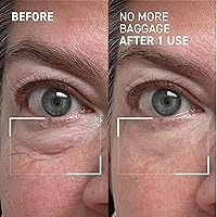 Dr. Brandt Needles No More No More Baggage Eye De-Puffing Gel, 0.23oz — image 4