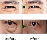 Abera Eye Roller Serum for Men – 0.34 fl oz — image 5