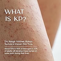 HealFast KP Bump Eraser Cream 4oz — image 2