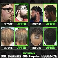 BBS Beard Growth Serum — image 5