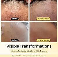 Gleamin Vitamin C Face Wash 2 percent Salicylic Acid 3.4 fl oz — image 2