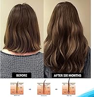 Pronexa Hairgenics Clinical Strength Hair Growth Shampoo 8oz — image 7