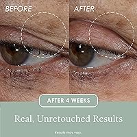 Crepe Erase Lift & Smooth Eyelid Treatment 0.77oz — image 5