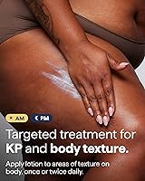 Remedy Science KP Body Treatment Lotion – 5.5oz — image 4