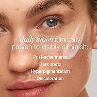 First Aid Beauty Lactic Acid Lotion 1oz — image 2