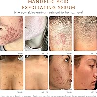 AlmondClear Face & Body Clearing Serum Level 1 - 1 fl oz — image 3