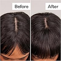 ACT+ ACRE Plant-Based Fulvic Acid Volumizing Dry Shampoo — image 6