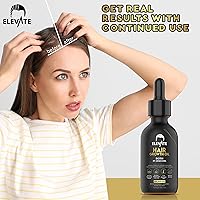 Elevate Hair Regrowth Treatment 5% Minoxidil Solution 2oz — image 4