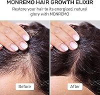 MONREMO Hair Growth Serum with Turmeric, Caffeine & Biotin – 7.37oz — image 2