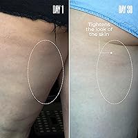 MAËLYS B-TIGHT Leave-On Cellulite Mask 100mL — image 4