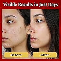 FACEDOCTOR Complexion Bar Soap 3.35oz — image 4