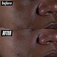 Kiehl's Ultra Pure High-Potency 9.8% Glycolic Acid Serum — image 3