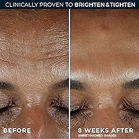 RoC Multi Correxion Revive + Glow Vitamin C Serum, 1oz — image 4