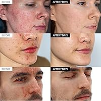 IVOSKIN Intensive Cica Repair Cream 1.76oz — image 7