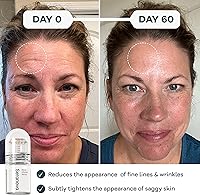 Seranova Micro Infusion System for Face & Neck — image 7