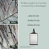 Good&All Dry Itchy Scalp Treatment, 5.58 fl oz — image 2