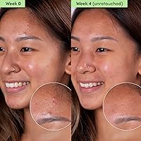 Sand & Sky Oil Control Blemish Clearing Clay Face Mask — image 5