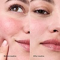 Clinique Redness Solutions Daily Relief Cream 1.7oz — image 7