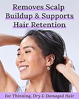 Keranique Micro Exfoliating Scalp Mask — image 2