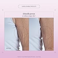 philosophy Ultimate Miracle Worker Resurfacing Body Serum 6.5oz — image 4