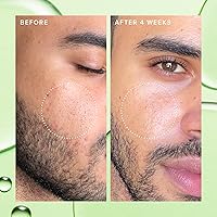 Farmacy 2% Salicylic Acid Toner - 120mL — image 4