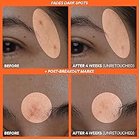 Innisfree Green Tea Enzyme Vitamin C Serum 4.87oz — image 4