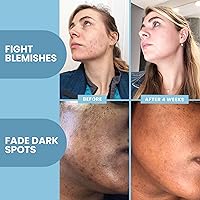 Eva Naturals Vitamin C Serum with Retinol & Salicylic Acid, 2oz — image 7