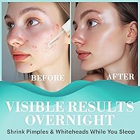 Repechage Drying Lotion Acne Spot Treatment 0.25oz — image 2