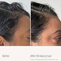 Living Proof Scalp Care Density Serum 5.29oz — image 3