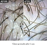 Love Ur Curls Exfoliating Scalp Scrub 150mL — image 3