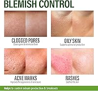 GRAMRIGHT Acne Treatment Face Cream 4 fl.oz — image 4