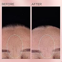 Elizabeth Arden Retinol + HPR Ceramide Rapid Skin Renewing Anti-Aging Face Serum Capsules — image 8