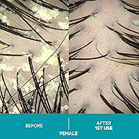 DS Labs Dandrene Dandruff Conditioner 205mL — image 3