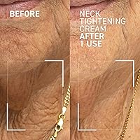 Dr. Brandt Needles No More Neck Tightening Cream 1.7oz — image 2