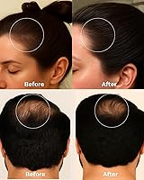 Keyoma Batana Oil for Hair Growth with Rosemary 30mL — image 6