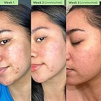 Sand & Sky Oil Control Blemish Clearing Clay Face Mask — image 6