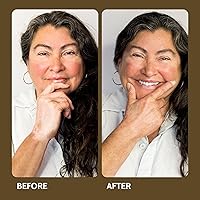 Fake Bake Vitiligo Vanquish Cosmetic Camouflage Kit — image 4