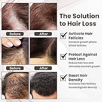 PeptideLabz Copper Peptide 10% GHK-CU & 5% AHK-CU Hair Growth Serum — image 5