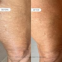 OneSkin BODY OS-01 Peptide Skin Longevity Daily Moisturizer 250mL — image 4