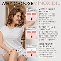 Minoxidil for Women 5% Hair Regrowth Treatment Foam 3-Month Supply — image 3