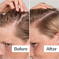 ACT+ ACRE Cold Processed Salicylic Acid Exfoliator 2 Fl Oz — image 3