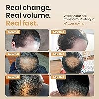 VITASEI Hair Booster Serum 2 Fl Oz — image 3