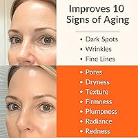 LeVaye Vitamin C Serum 15% with Hyaluronic Acid and Niacinamide — image 3