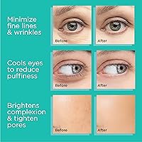 MonétBeauty Stainless Steel Ice Globes for Facials (Gold) — image 6