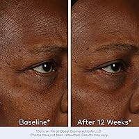 Obagi ELASTIderm Facial Serum – 1oz — image 4